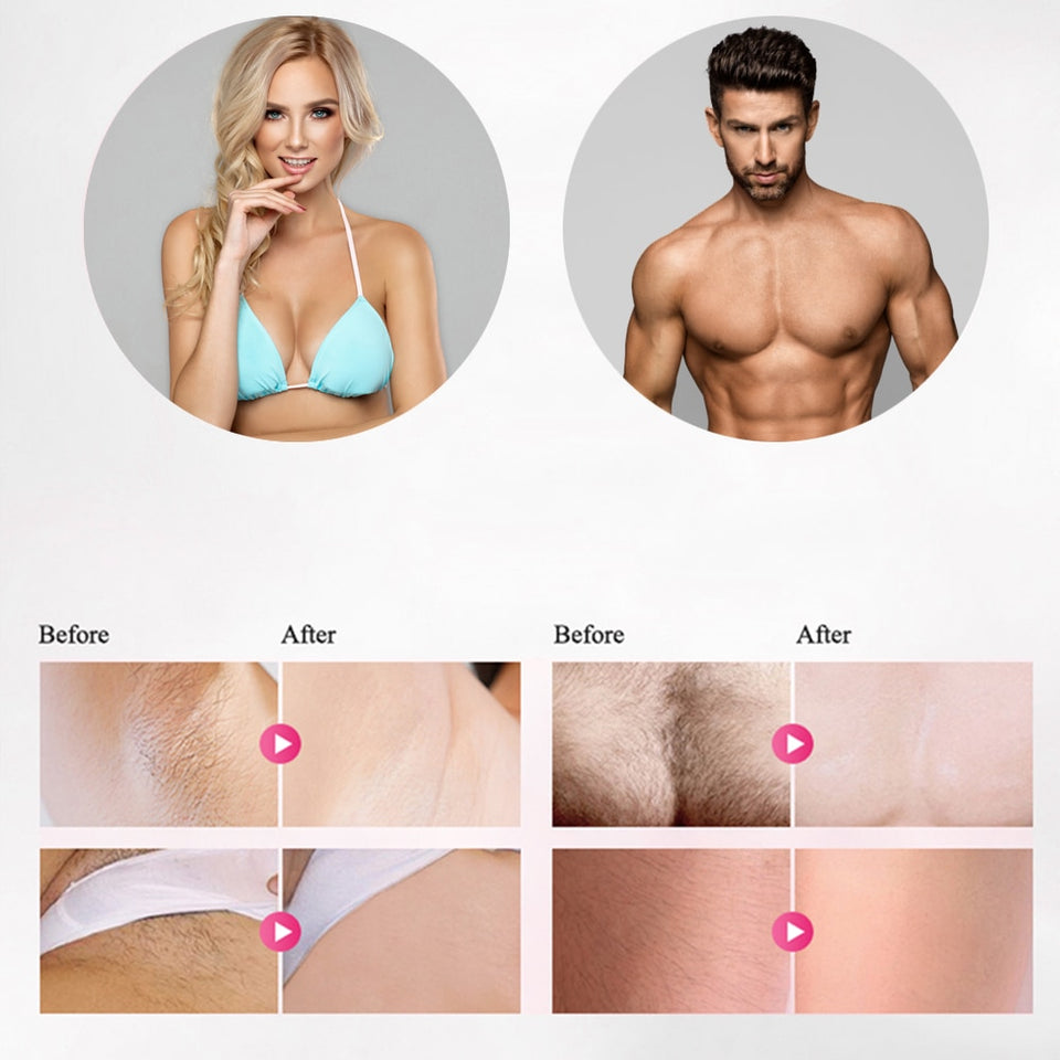 Professional permanent IPL epilator laser hair removal