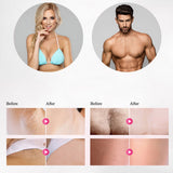 Professional permanent IPL epilator laser hair removal